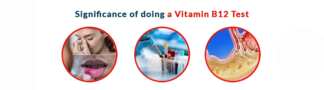 Significance of Doing a Vitamin B12 Test